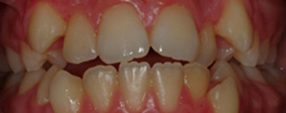 Before & Afters