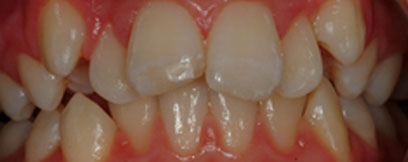 Before & Afters