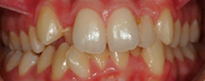 Before & Afters
