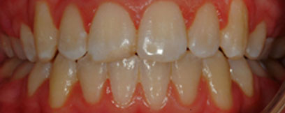 Before & Afters
