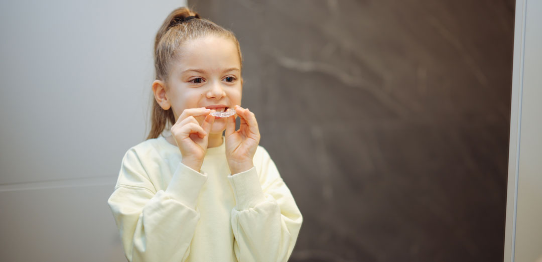Are Clear Aligners Available On The NHS? Your Options Explained