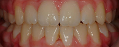 Before & Afters