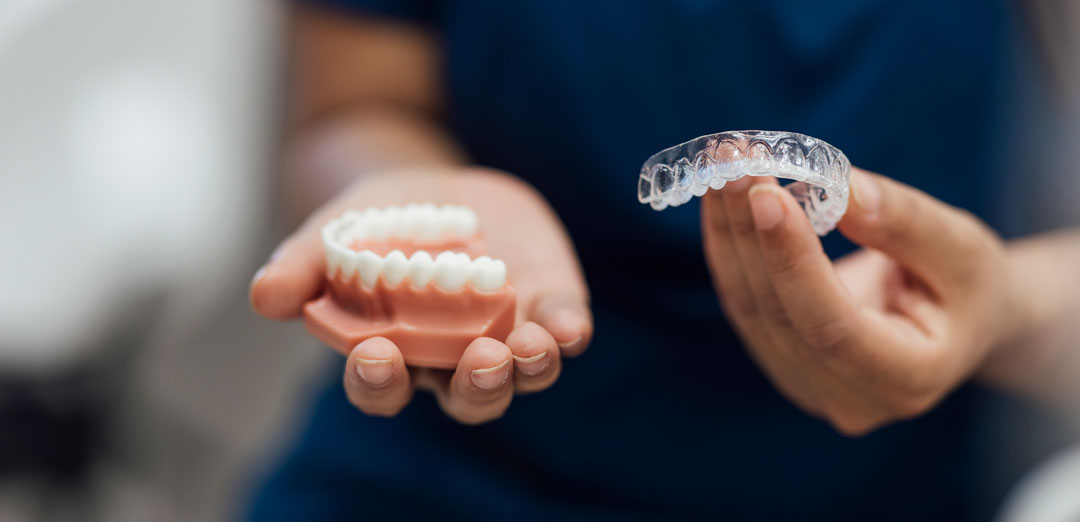 Braces vs aligners - which is best for adults?